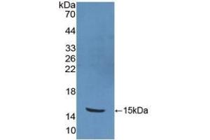 Detection of Recombinant PKIb, Human using Polyclonal Antibody to Protein Kinase Inhibitor Beta (PKIb) (PKIB 抗体  (AA 8-76))
