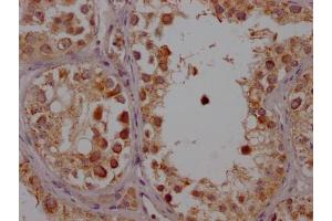 IHC image of ABIN7127446 diluted at 1:100 and staining in paraffin-embedded human testis tissue performed on a Leica BondTM system. (Recombinant CYP17A1 抗体)