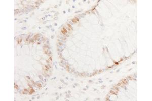 Immunohistochemistry (IHC) image for anti-Caudal Type Homeobox 2 (CDX2) (C-Term) antibody (ABIN7454664)