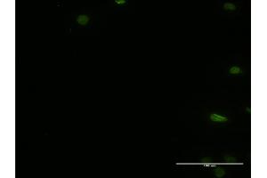 Immunofluorescence of monoclonal antibody to PTBP2 on HeLa cell. (PTBP2 抗体  (AA 35-175))