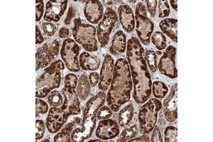 Immunohistochemical staining of human kidney with ZNF445 polyclonal antibody  shows strong granular cytoplasmic positivity in tubular cells. (ZNF445 抗体)