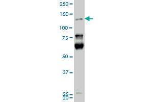 HIPK2 monoclonal antibody (M01), clone 4F4. (HIPK2 抗体  (AA 961-1065))
