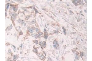Immunohistochemistry (IHC) image for anti-Growth Factor Receptor-Bound Protein 10 (GRB10) (AA 392-594) antibody (ABIN7436048)