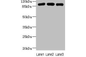 Western blot All lanes: ASAP3 antibody at 1 μg/mL Lane 1: A549 whole cell lysate Lane 2: MCF-7 whole cell lysate Lane 3: K562 whole cell lysate Secondary Goat polyclonal to rabbit IgG at 1/10000 dilution Predicted band size: 100, 44, 98 kDa Observed band size: 100 kDa (ASAP3 抗体  (AA 451-700))
