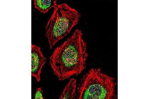 Fluorescent confocal image of Hela cell stained with NRK Antibody (Center) (ABIN1881588 and ABIN2846418). (NRK 抗体  (AA 721-750))