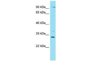 Host:  Rabbit  Target Name:  Nkx3-1  Sample Type:  Mouse Lung lysates  Antibody Dilution:  1. (NKX3-1 抗体  (Middle Region))