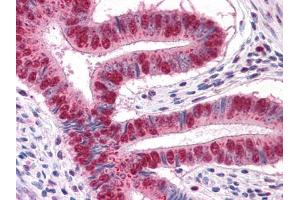 Immunohistochemical analysis of paraffin-embedded human Uterus tissues using MUM1 mouse mAb (MUM1 抗体)