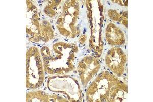 Immunohistochemistry of paraffin-embedded human kidney using RAB1B antibody. (RAB1B 抗体  (AA 7-201))