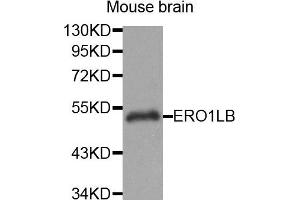 Western Blotting (WB) image for anti-ERO1-Like beta (ERO1LB) antibody (ABIN1875678) (ERO1LB 抗体)