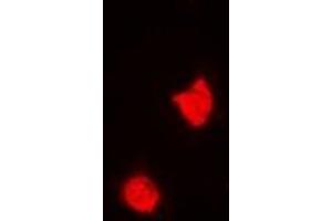 Immunofluorescent analysis of TREX1 staining in A549 cells. (TREX1 抗体)