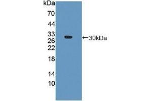 Detection of Recombinant PSMa5, Human using Polyclonal Antibody to Proteasome Subunit Alpha Type 5 (PSMa5) (PSMA5 抗体  (AA 1-241))