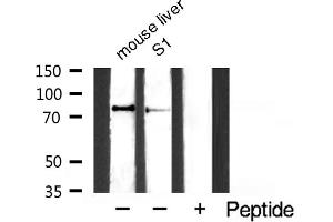 Western blot analysis of TIMP4 expression in NIH-3T3 whole cell lysates,The lane on the left is treated with the antigen-specific peptide. (IKK alpha 抗体  (pSer176, pSer177))