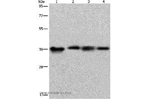 Western blot analysis of HepG2 and 293T cell, human kidney cancer tissue and K562 cell, using F11R Polyclonal Antibody at dilution of 1:500 (F11R 抗体)