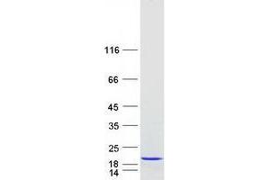 Validation with Western Blot