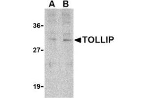 Image no. 1 for anti-Toll Interacting Protein (TOLLIP) (C-Term) antibody (ABIN265153) (TOLLIP 抗体  (C-Term))