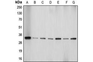 Western blot analysis of Aquaporin 4 expression in HeLa (A), Jurkat (B), PC12 (C), SP2/0 (D), HepG2 (E), U87MG (F), mouse brain (G) whole cell lysates. (Aquaporin 4 抗体  (Center))