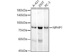 Western blot analysis of extracts of various cell lines, using NPHP1 antibody (ABIN7268847) at 1:1000 dilution. (NPHP1 抗体)
