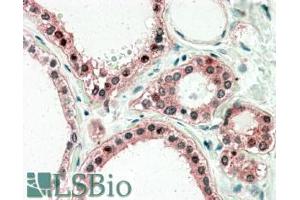 ABIN334523 (5µg/ml) staining of paraffin embedded Human Thyroid Gland. (UXT 抗体  (C-Term))