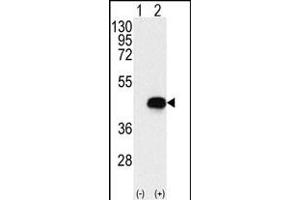 Western blot analysis of BCKDK (arrow) using rabbit polyclonal BCKDK Antibody (Center) (ABIN391176 and ABIN2841276). (BCKDK 抗体  (AA 120-151))
