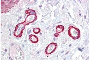 Anti-SLC39A14 antibody IHC staining of human colon, vessels. (SLC39A14 抗体  (Internal Region))