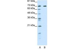 WB Suggested Anti-FOXK2  Antibody Titration: 0. (Forkhead Box K2 抗体  (Middle Region))