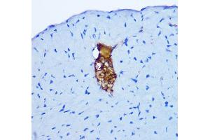 Immunohistochemistry of paraffin-embedded mouse heart using GRP Rabbit pAb (ABIN6127573, ABIN6141433, ABIN6141434 and ABIN6222002) at dilution of 1:100 (40x lens). (Gastrin-Releasing Peptide 抗体  (AA 1-148))