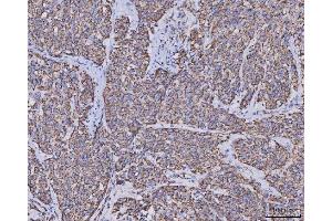 IHC analysis of MDH2 using anti-MDH2 antibody (ABIN7602617).