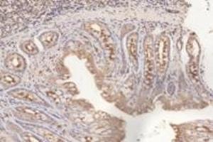 Immunohistochemistry analysis of paraffin-embedded rat colon using,PFDN4 (ABIN7075171) at dilution of 1: 4200 (PFDN4 抗体)