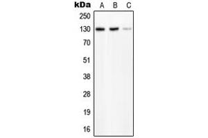 Western blot analysis of PLC beta 2 expression in HeLa (A), SP2/0 (B), H9C2 (C) whole cell lysates. (Phospholipase C beta 2 抗体  (Center))