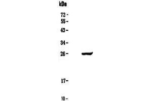 Western blot analysis of Serum Amyloid P using anti-Serum Amyloid P antibody . (APCS 抗体  (AA 20-220))