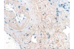 Detection of ELN in Human Liver Tissue using Monoclonal Antibody to Elastin (ELN) (Elastin 抗体  (AA 392-645))