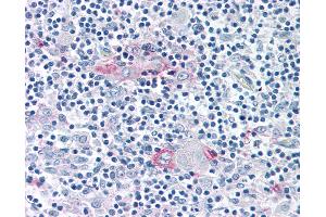 Anti-ROR Gamma antibody IHC of human thymus. (RORC 抗体  (Ligand Binding Domain))