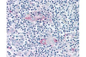Anti-ROR Gamma antibody IHC of human thymus.