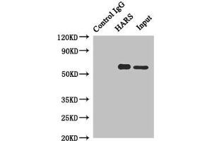 Immunoprecipitating HARS in Hela whole cell lysate Lane 1: Rabbit control IgG instead of (1 μg) instead of ABIN7155257 in Hela whole cell lysate. (HARS1/Jo-1 抗体  (AA 1-180))