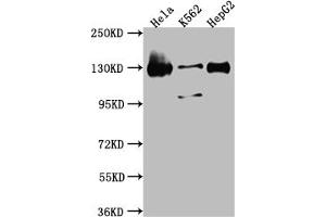 Western Blot Positive WB detected in: Hela whole cell lysate, K562 whole cell lysate, HepG2 whole cell lysate All lanes: Bub1 antibody at 1:1000 Secondary Goat polyclonal to rabbit IgG at 1/50000 dilution Predicted band size: 123, 116, 120 kDa Observed band size: 130 kDa (Recombinant BUB1 抗体)