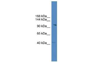 KIAA1604 antibody used at 0. (CWC22 抗体  (C-Term))