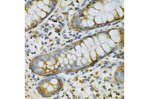 Immunohistochemistry of paraffin-embedded human colon using GSTM2 Antibody (ABIN6292965) at dilution of 1:100 (40x lens). (GSTM2 抗体)