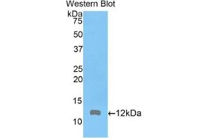 Detection of Recombinant ARPC4, Mouse using Polyclonal Antibody to Actin Related Protein 2/3 Complex Subunit 4 (ARPC4) (ARPC4 抗体  (AA 79-164))