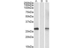 Lane A - ABIN571107 (1µg/ml) staining of HEK293 overexpressing Human DYDC1 lysate (10µg protein in RIPA buffer) Lane B - ABIN571107 (0. (DYDC1 抗体  (AA 142-154))