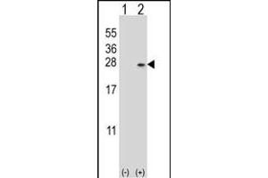 Western blot analysis of DUSP14 (arrow) using rabbit polyclonal DUSP14 Antibody (M1) (ABIN392877 and ABIN2842285). (DUSP14 抗体  (N-Term))