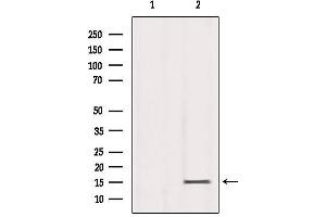 Western blot analysis of extracts from Mouse Spleen, using Histone H3K79me3 Antibody. (Histone 3 抗体  (H3K79me3))