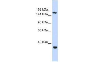 EIF4G3 antibody used at 1 ug/ml to detect target protein. (EIF4G3 抗体  (Middle Region))