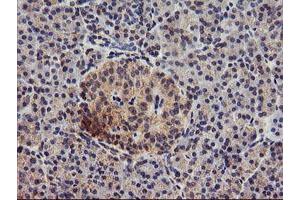 Immunohistochemical staining of paraffin-embedded Human pancreas tissue using anti-DGKA mouse monoclonal antibody. (DGKA 抗体)