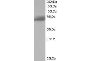 ABIN185183 staining (1µg/ml) of Human Brain lysate (RIPA buffer, 35µg total protein per lane). (SH3BP1 抗体  (C-Term))
