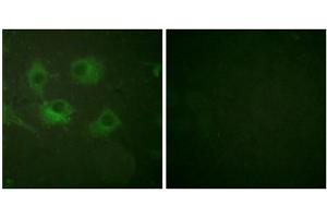 Immunofluorescence analysis of HuvEc cells, using Claudin 3 antibody (ABIN5976357). (Claudin 3 抗体  (C-Term))