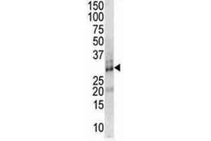DSCR1 antibody used in western blot to detect DSCR1 in endothelial cell lysate (RCAN1 抗体  (AA 75-104))