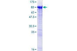 CROT Protein (AA 1-612) (GST tag)
