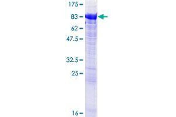 CROT Protein (AA 1-612) (GST tag)