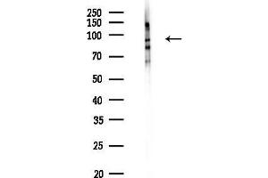 anti-HEAT Repeat Containing 2 (HEATR2) (Internal Region) antibody