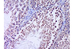 Paraformaldehyde-fixed, paraffin embedded Rat testis Antigen retrieval by boiling in sodium citrate buffer (pH6.